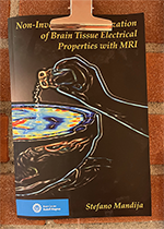 ISBN: 9789039369043 - Title: Non-Invasive Characterization of Brain Tissue Electrical Properties with MRI 